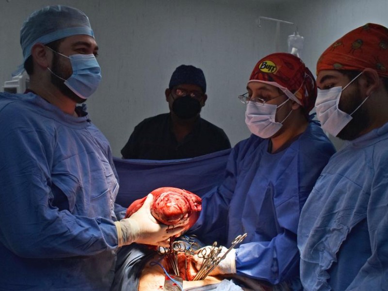 Extirpan tumor de 4 kilos en IMSS de Chicontepec
