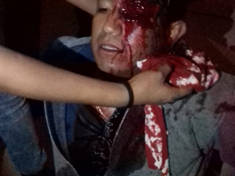 Fuerte accidente en la Avenida de La Juventud