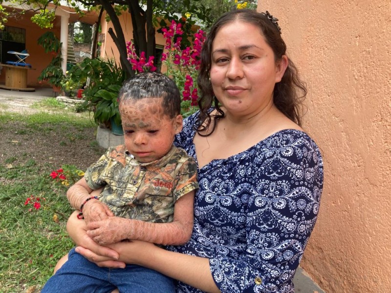 Gerardito de tres años padece una rara enfermedad; busca ayuda
