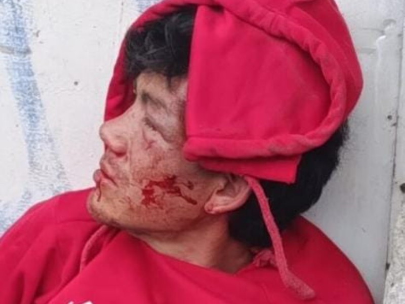 Golpean a asaltante de abuelita en la colonia Santa María