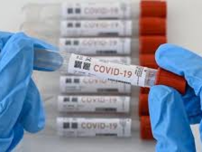 Hay pruebas rezagadas de COVID-19 en Puebla