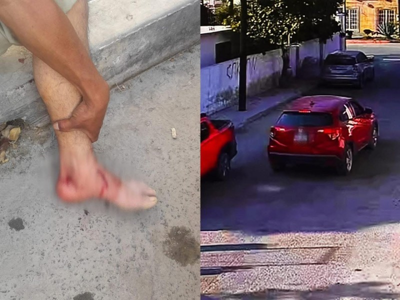 Hombre resulta herido por arma de fuego