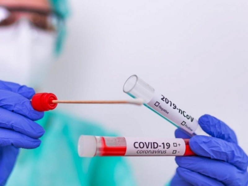 Inicia aplicación de pruebas antígeno para detectar COVID-19 en Zihuatanejo
