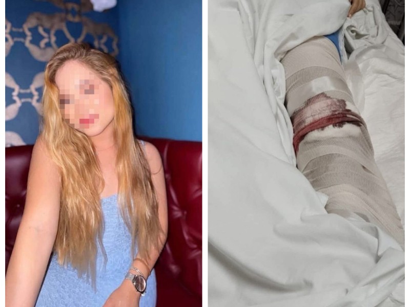 Inician investigación por tentativa de feminicidio por el caso de Ximena 