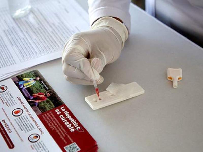 Jalisco décimo lugar nacional en casos de hepatitis