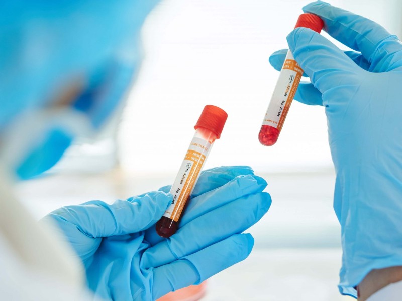 Japón y la revolución de la sangre artificial
