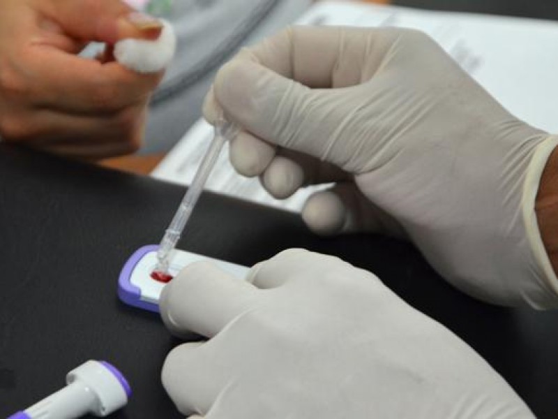 Jornadas de detección de VIH han bajado los contagios