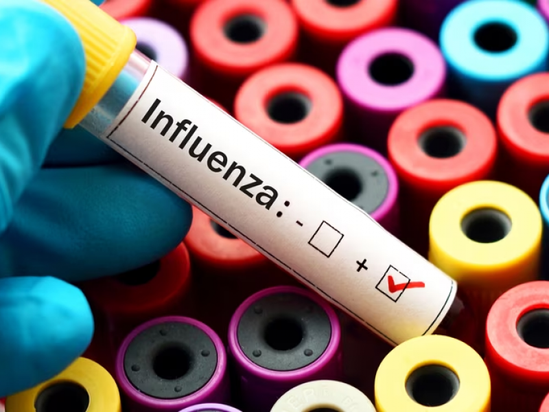 La influenza un problema que sigue vigente