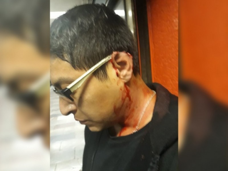 Le arrancan pedazo de oreja en el Metro