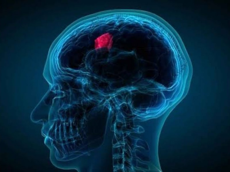 Logran que quimioterapia penetre cerebro contra un tumor mortal