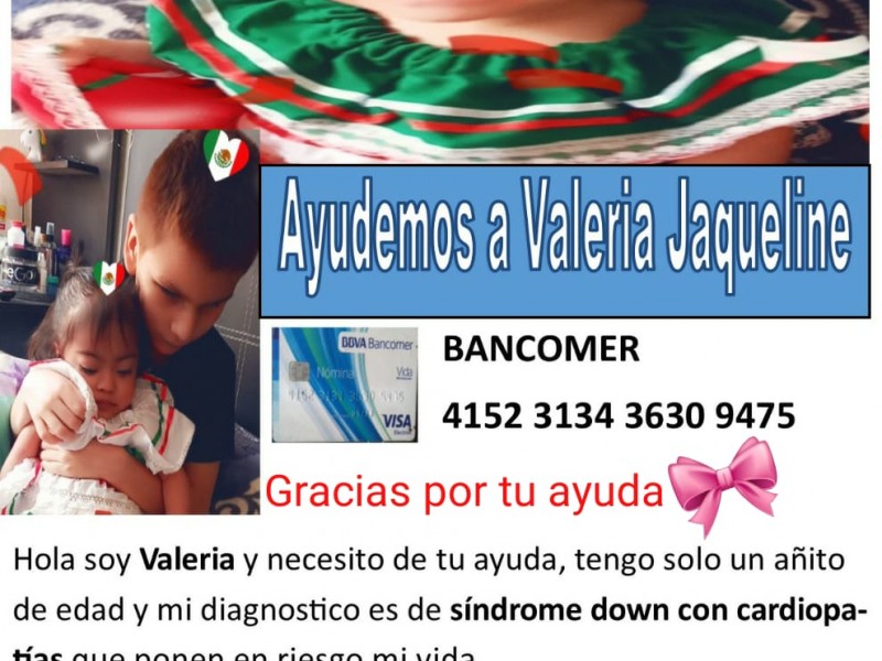 Madre solicita apoyo para cirugía de su pequeña Valeria