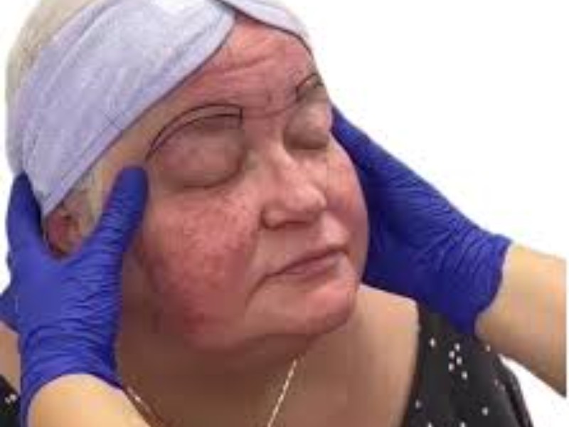 Medicina estética oncológica mejorara calidad de vida de pacientes: Especialista