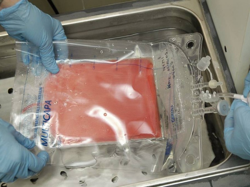 Médula ósea, para enfermedades de la sangre