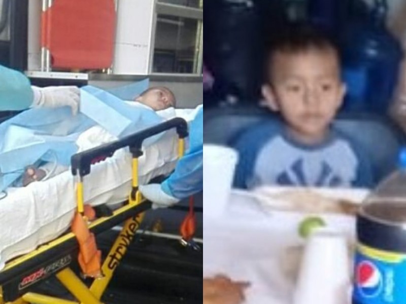 Menor se quema con agua hirviendo y familia pide ayuda 