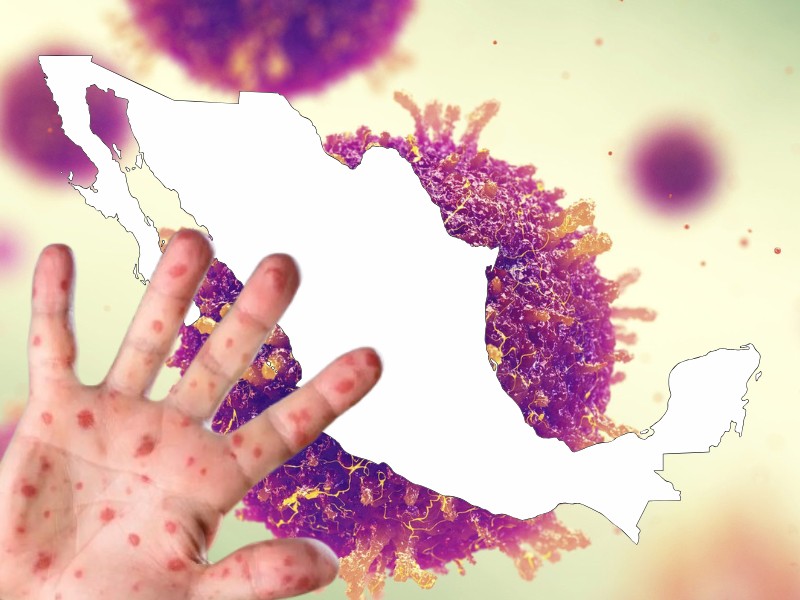 México lidera contagios de sarampión en América: descubre los detalles