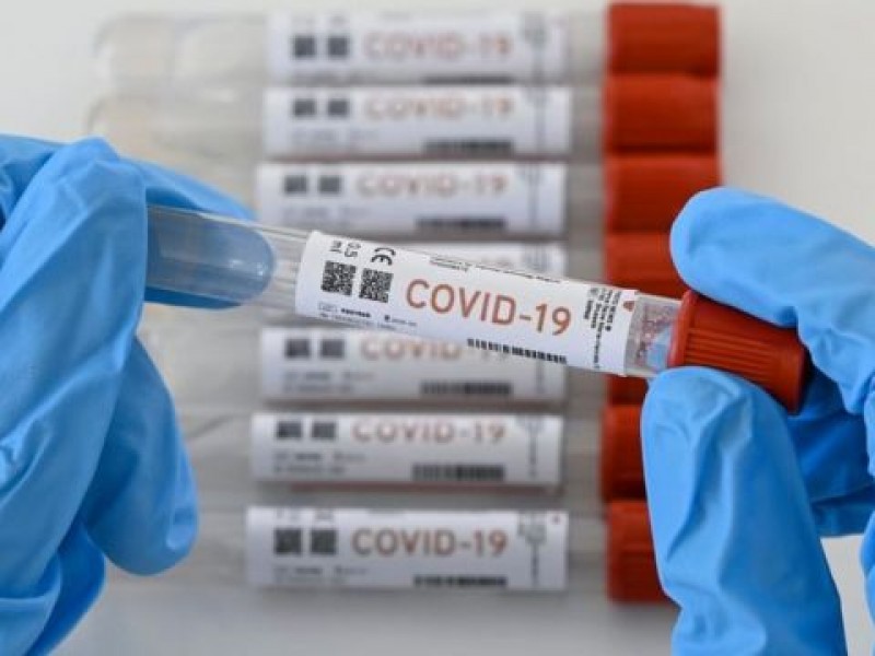 México registra 6 mil 343 nuevos contagios de Covid-19