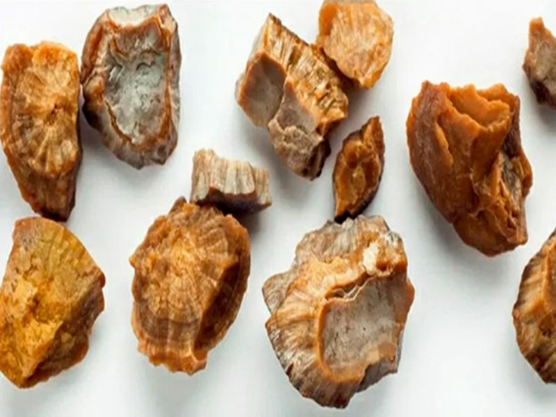 Mitos sobre las piedras en los riñones