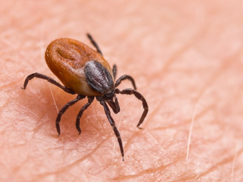 Muere menor de seis años por picadura de garrapata en La Laguna