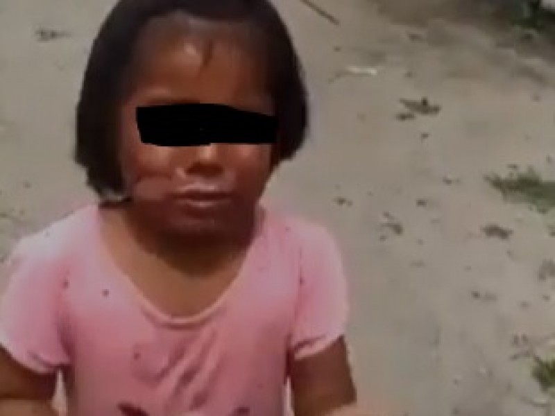 Mujer quema a su hija y nieta, ocurrió en Tecamachalco