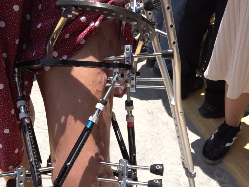 Municipio ignora a ciclista y su propuesta de mejora vial