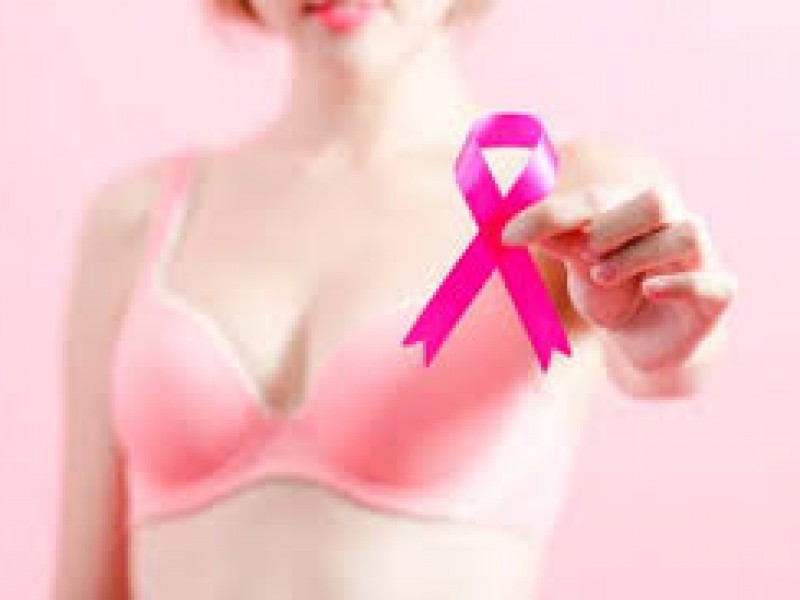 No se registraron pacientes COVID con cáncer de mama