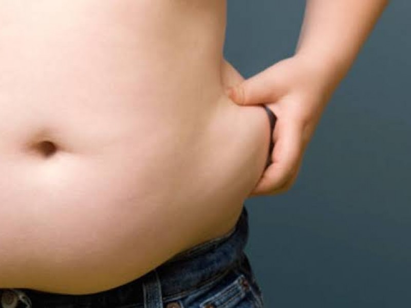 Obesidad provoca incremento de enfermedades crónico degenerativas