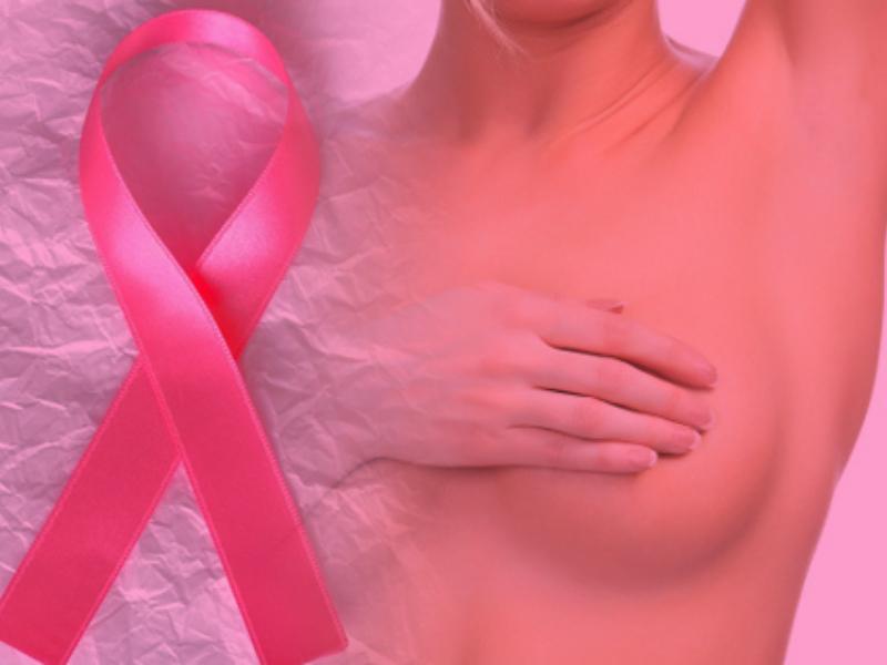 Ofrecen 300 estudios gratuitos para detectar cáncer de mama en Mazatlán