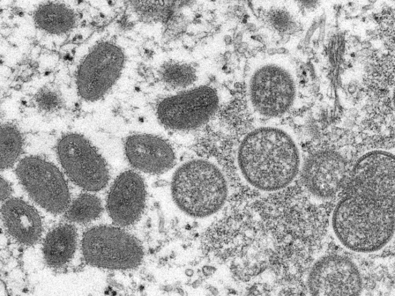 OMS evaluará condiciones de la viruela símica
