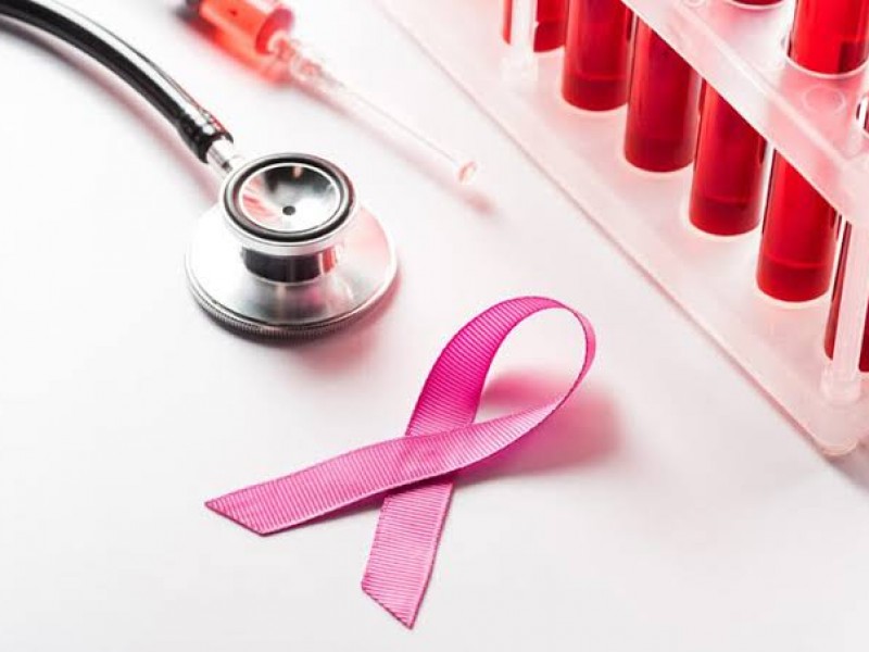 Optimizar terapia de cáncer de mama permitiría evitar la quimio