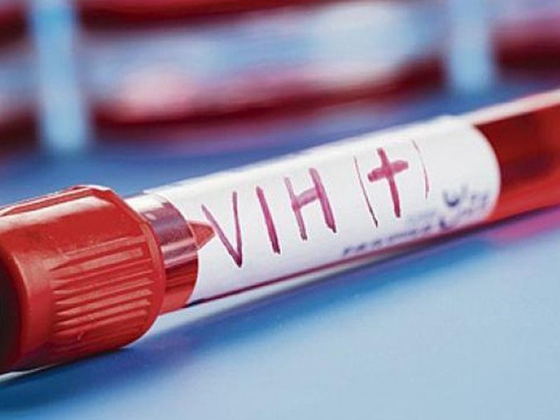 Pacientes con VIH-SIDA sin problemas por falta de medicinas