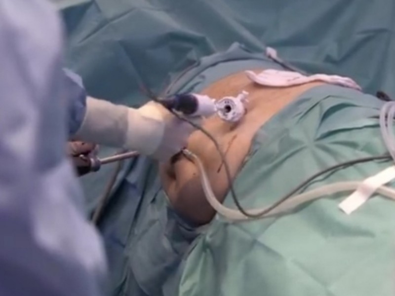 Pacientes trasplantados de riñón y sus cuidados en pandemia