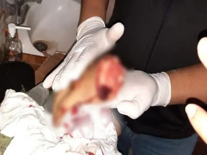 Padre le corta la mano a su hijo en Hueytamalco