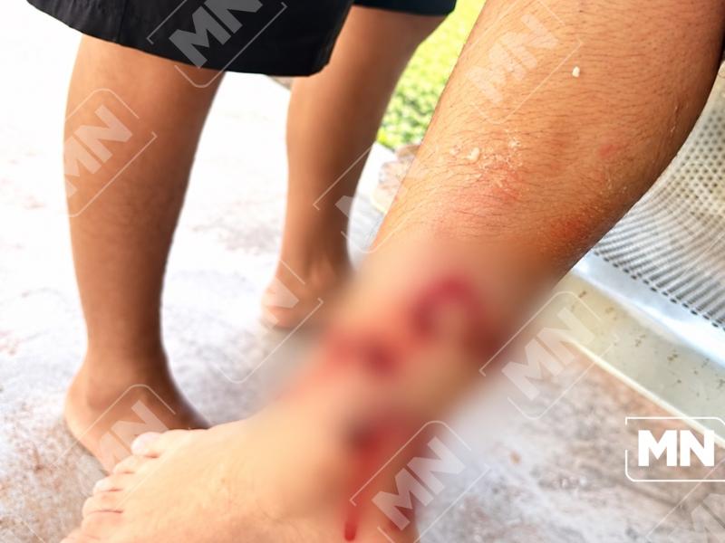 Perro ataca a niño de 10 años en La Unión
