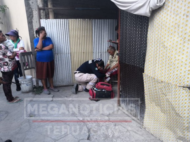 Perro ataca a señora de la tercera edad