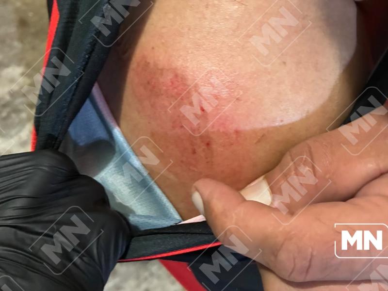 Persona en cuatrimoto resulta lesionado durante la Ruta del Terror en Petatlán