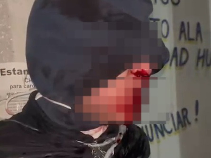 Presunto ladrón rescatado de linchamiento en Valle de Chalco