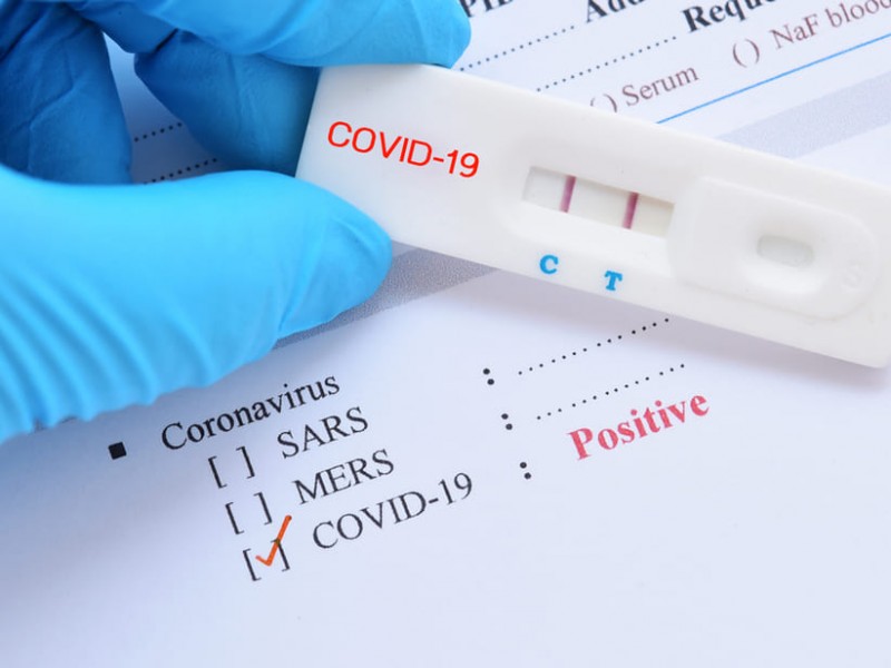 Pruebas rápidas pueden ser confiables para detectar COVID-19