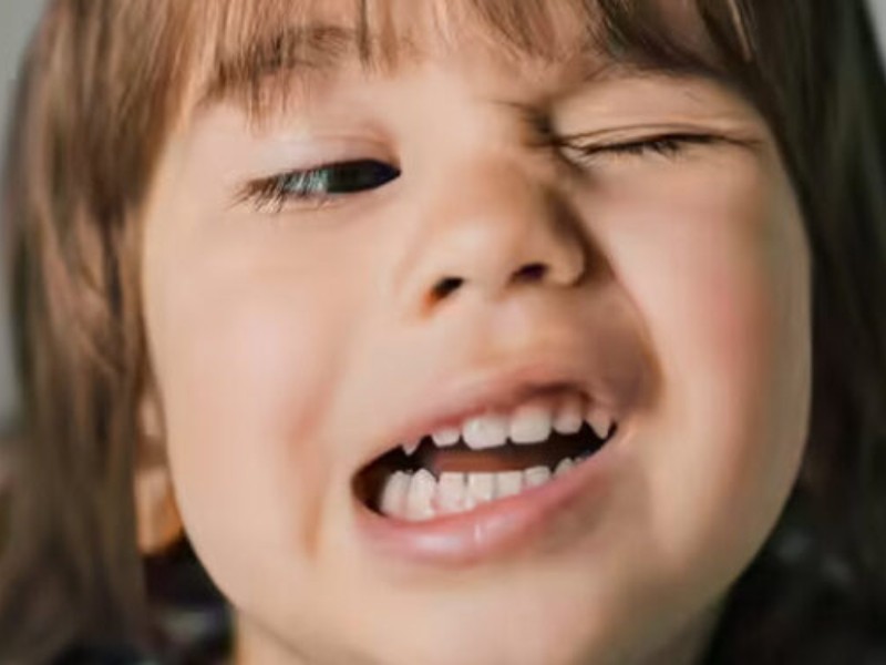 ¿Qué es el síndrome de tourette?
