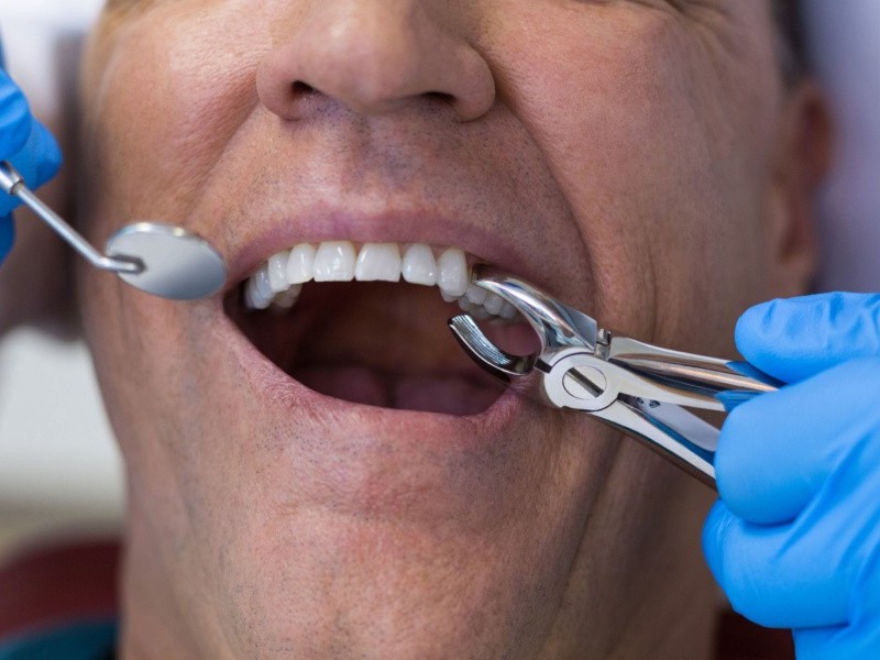 Realizarán jornada gratuita de extracciones dentales en la Facultad de Odontología