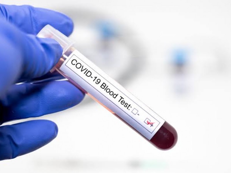 Registra Zacatecas los 155 casos positivos de Coronavirus