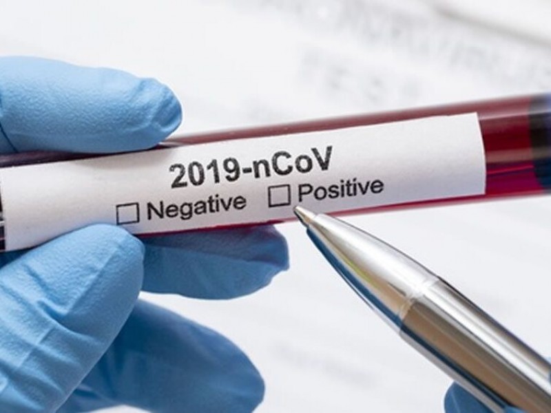 Registran 50 nuevos contagios de coronavirus durante fin de semana