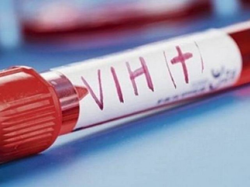 Registran leve aumento de casos de VIH en BCS
