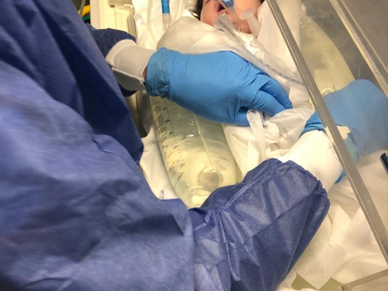 Regresa a Michoacán bebé operado de gravedad en León