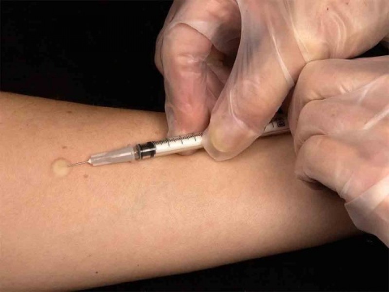 Reino Unido advierte a personas con alergias aplicarse vacuna Pfizer