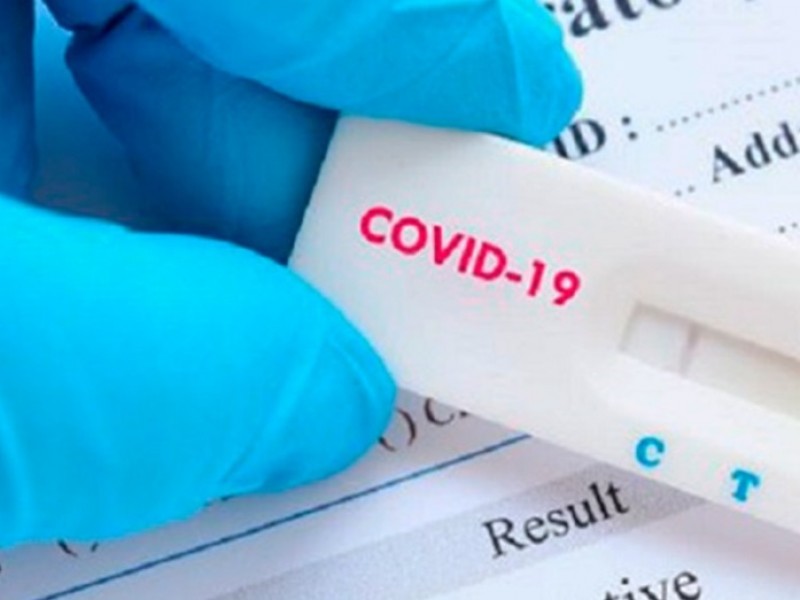 Salud advierte venta de prueba Covid-19 sin registro sanitario