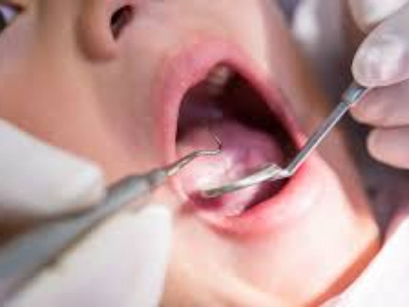 Salud bucodental en México  un desafío  de salud publica