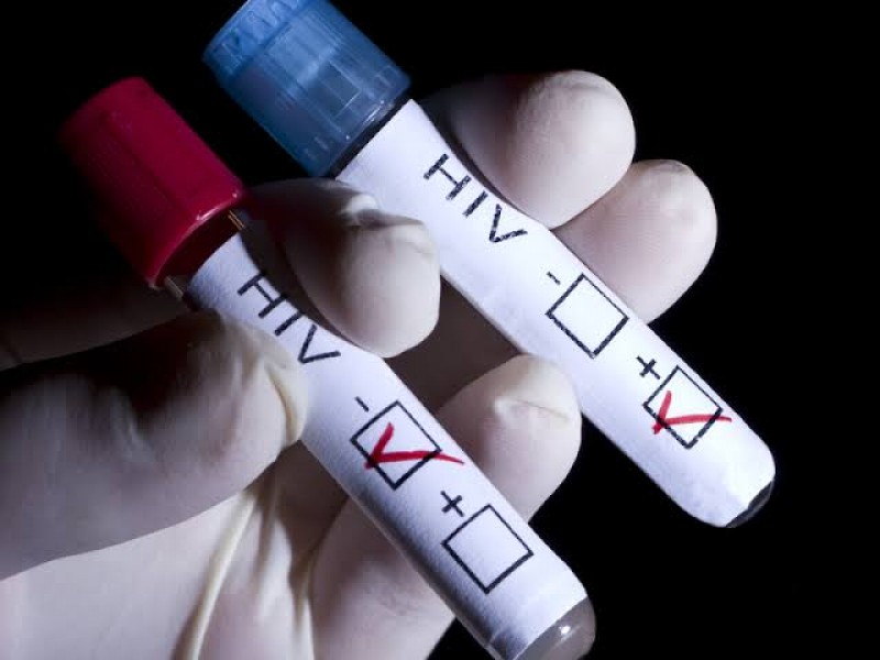 Salud municipal brindará pruebas gratuitas de VIH