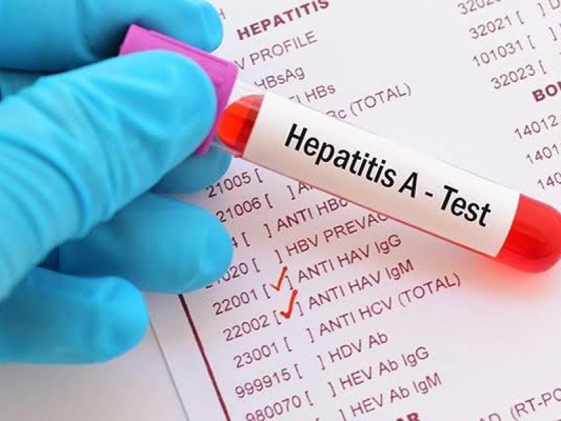 Se registran casos de Hepatitis en San Cristóbal