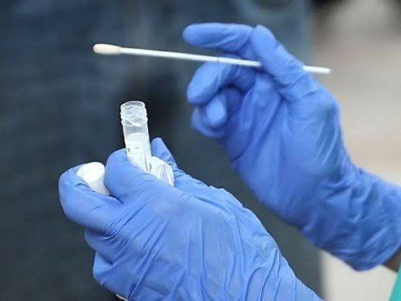 Sensor basado en anticuerpos químicos detecta el SARS-CoV-2 en saliva