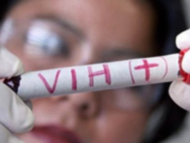 Sonora: Fallecen mas de 100 personas por secuelas de SIDA
